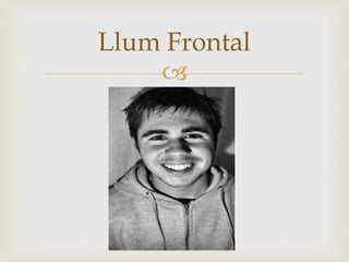 
Llum Frontal
 