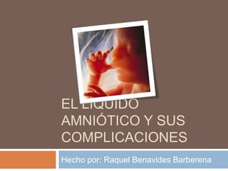 El Líquido amniótico y sus complicaciones Hecho por: Raquel Benavides Barberena 
