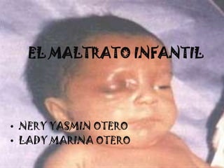 EL MALTRATO INFANTIL




• NERY YASMIN OTERO
• LADY MARINA OTERO
 