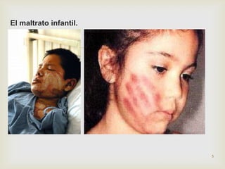 El maltrato infantil.


                        




                            5
 