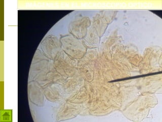 IMÁGENES EN EL MICROSCOPIO OPTICO:
IMÁGENES EN EL MICROSCOPIO OPTICO:

 