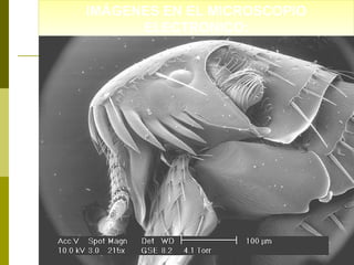 IMÁGENES EN EL MICROSCOPIO
IMÁGENES EN EL MICROSCOPIO
ELECTRONICO:
ELECTRONICO:

 