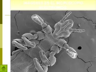 IMÁGENES EN EL MICROSCOPIO
IMÁGENES EN EL MICROSCOPIO
ELECTRONICO:
ELECTRONICO:

 
