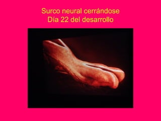 Surco neural cerrándose
 Día 22 del desarrollo
 
