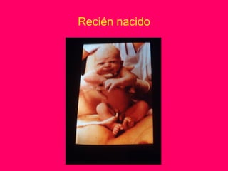 Recién nacido
 