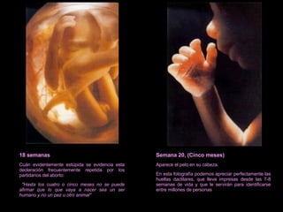 18 semanas Cuán evidentemente estúpida se evidencia esta declaración frecuentemente repetida por los partidarios del aborto: "Hasta los cuatro o cinco meses no se puede afirmar que lo que vaya a nacer sea un ser humano y no un pez u otro animal" Semana 20, (Cinco meses) Aparece el pelo en su cabeza. En esta fotografía podemos apreciar perfectamente las huellas dactilares, que lleva impresas desde las 7-8 semanas de vida y que le servirán para identificarse entre millones de personas 