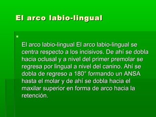 El arco labio-lingual


    El arco labio-lingual El arco labio-lingual se
    centra respecto a los incisivos. De ahí se dobla
    hacia oclusal y a nivel del primer premolar se
    regresa por lingual a nivel del canino. Ahí se
    dobla de regreso a 180° formando un ANSA
    hasta el molar y de ahí se dobla hacia el
    maxilar superior en forma de arco hacia la
    retención.
 