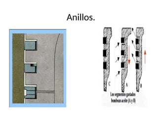 Anillos.
 
