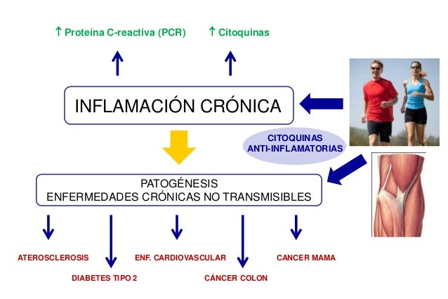 cancer y proteina c reactiva cancer y proteina c reactiva cancer y proteina c reactiva cancer y proteina c reactiva