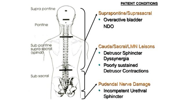 Neurological Disorders Of The Bladder Pelvic Floor A Holistic App