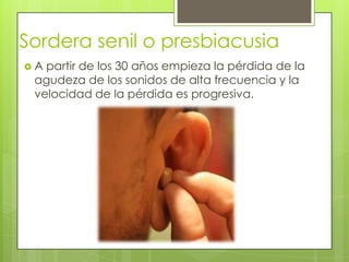 Sordera senil o presbiacusia
A

partir de los 30 años empieza la pérdida de la
agudeza de los sonidos de alta frecuencia y la
velocidad de la pérdida es progresiva.

 