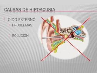  OIDO EXTERNO
 PROBLEMAS
 SOLUCIÓN
 