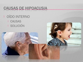  OÍDO INTERNO
 CAUSAS
 SOLUCIÓN
 