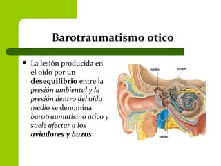 Barotraumatismo otico
 La lesión producida en
el oído por un
desequilibrio entre la
presión ambiental y la
presión dentro del oído
medio se denomina
barotraumatismo otico y
suele afectar a los
aviadores y buzos
 