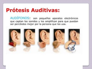AUDÍFONOS:

son pequeños aparatos electrónicos
que captan los sonidos y los amplifican para que puedan
ser percibidos mejor por la persona que los usa.

 