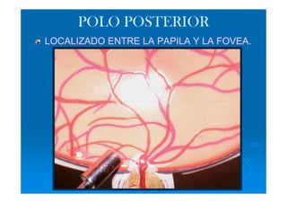 POLO POSTERIOR
LOCALIZADO ENTRE LA PAPILA Y LA FOVEA.
 