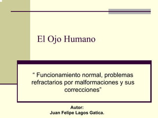 El Ojo Humano


 “ Funcionamiento normal, problemas
refractarios por malformaciones y sus
             correcciones”

                Autor:
      Juan Felipe Lagos Gatica.
 