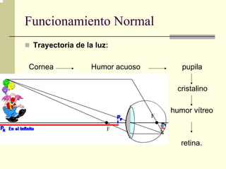 Funcionamiento Normal
 Trayectoria de la luz:

Cornea            Humor acuoso      pupila

                                  cristalino

                                 humor vítreo



                                   retina.
 