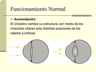 Funcionamiento Normal
   Acomodación:
El cristalino cambia su estructura, por medio de los
músculos ciliares ante distintas posiciones de los
objetos a enfocar.
 