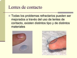 Lentes de contacto
 Todas los problemas refractarios pueden ser
 mejorados a través del uso de lentes de
 contacto, existen distintos tipo y de distintos
 materiales
 