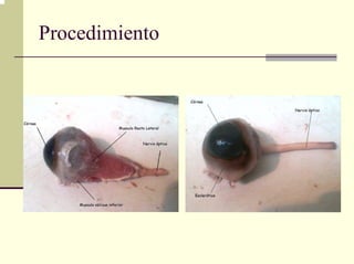 Procedimiento
 