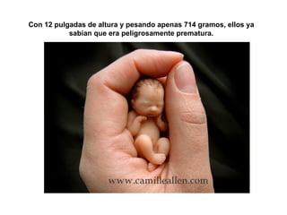 Con 12 pulgadas de altura y pesando apenas 714 gramos, ellos ya sabían que era peligrosamente prematura. 