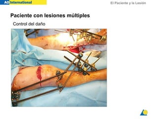 El Paciente y la Lesión
Control del daño
Paciente con lesiones múltiples
 