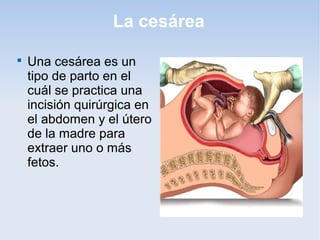 La cesárea

    Una cesárea es un
    tipo de parto en el
    cuál se practica una
    incisión quirúrgica en
    el abdomen y el útero
    de la madre para
    extraer uno o más
    fetos.
 