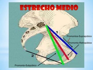 Promontos-Suprapúbico

                      Promonto-Retropúbico




Promonto-Subpúbico
 