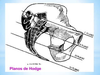 Planos de Hodge
 