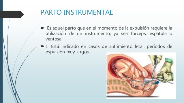 El Parto Y Sus Etapas