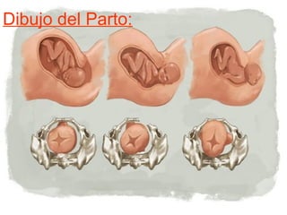 el parto y su repercusion en la educacion | PPT
