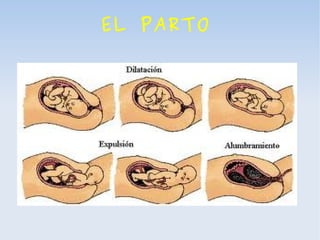 El parto ildefonso | PPT