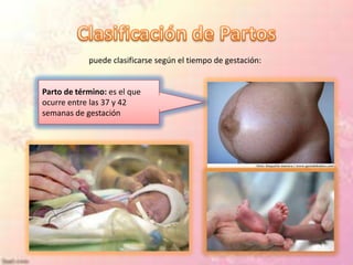 puede clasificarse según el tiempo de gestación:


Parto de término: es el que
ocurre entre las 37 y 42
semanas de gestación
 