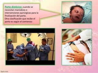 Parto distócico: cuando se
necesitan maniobras o
intervenciones quirúrgicas para la
finalización del parto.
Otra clasificación que recibe el
parto es según el comienzo:
 