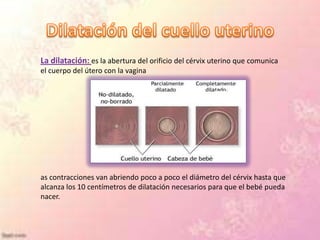 La dilatación: es la abertura del orificio del cérvix uterino que comunica
el cuerpo del útero con la vagina




as contracciones van abriendo poco a poco el diámetro del cérvix hasta que
alcanza los 10 centímetros de dilatación necesarios para que el bebé pueda
nacer.
 