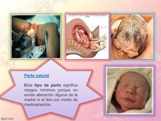 Parto natural

Este tipo de parto significa
riesgos mínimos porque no
existe alteración alguna de la
madre ni el feto por medio de
medicamentos.
 