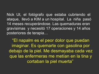 Nick  Ut,  el  fotógrafo  que  estaba  cubriendo  el ataque,  llevó a KIM a un hospital.  La  niña  pasó 14 meses recuperándose. Las quemaduras eran gravísimas  y necesitó 17 operaciones y 14 años posteriores de terapia…  “ El napalm es el peor dolor que puedan imaginar. Es quemarte con gasolina por debajo de la piel. Me desmayaba cada vez que las enfermeras me metían en la tina y cortaban la piel muerta”   