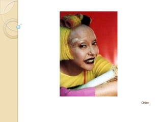 Orlan
 
