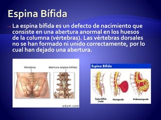  La espina bífida es un defecto de nacimiento que 
consiste en una abertura anormal en los huesos 
de la columna (vértebras). Las vértebras dorsales 
no se han formado ni unido correctamente, por lo 
cual han dejado una abertura. 
 
