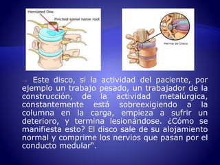  Este disco, si la actividad del paciente, por 
ejemplo un trabajo pesado, un trabajador de la 
construcción, de la actividad metalúrgica, 
constantemente está sobreexigiendo a la 
columna en la carga, empieza a sufrir un 
deterioro, y termina lesionándose. ¿Cómo se 
manifiesta esto? El disco sale de su alojamiento 
normal y comprime los nervios que pasan por el 
conducto medular“. 
 