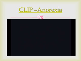 
CLIP –Anorexia
 