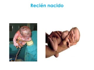 Recién nacido

 