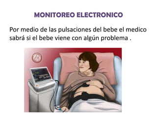 MONITOREO ELECTRONICO
Por medio de las pulsaciones del bebe el medico
sabrá si el bebe viene con algún problema .

 