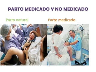 PARTO MEDICADO Y NO MEDICADO
Parto natural

Parto medicado

 