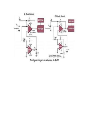 El proyecto tercer peiodo