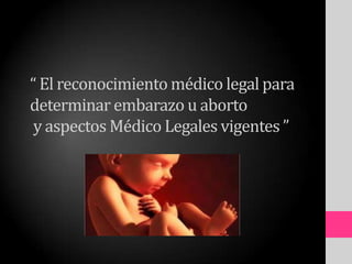 “ El reconocimiento médico legal para
determinar embarazo u aborto
y aspectos Médico Legales vigentes ”
 