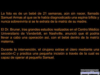 La foto es de un bebé de 21 semanas, aún sin nacer, llamado Samuel Armas al que se le había diagnosticado una espina bífida y nunca sobreviviría si se le extraía de la matriz de su madre. El Dr. Bruner, tras grandes estudios realizados en el Centro Médico Universitario de Vanderbilt, en Nashville, anunció que él podria llevar a cabo una operación así, con el bebé dentro de la matríz materna. Durante la intervención, el cirujano extrae el útero mediante una sección-C y practica una pequeña incisión a través de la cual es capaz de operar al pequeño Samuel. 