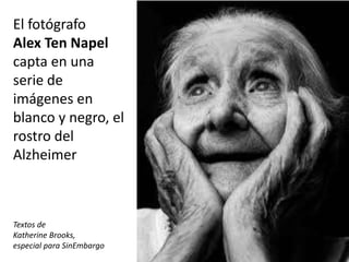 El fotógrafo 
Alex Ten Napel 
capta en una 
serie de 
imágenes en 
blanco y negro, el 
rostro del 
Alzheimer 
Textos de 
Katherine Brooks, 
especial para SinEmbargo 
 