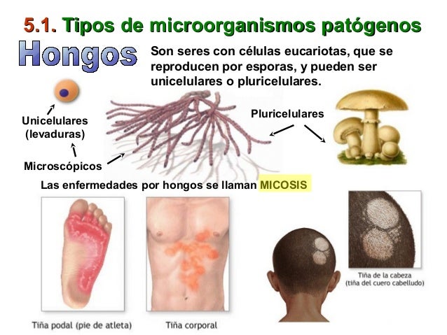 El ungüento contra el hongo sobre el alto
